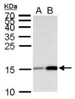 H3K18ac Antibody in Western Blot (WB)