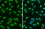 H3K18ac Antibody in Immunocytochemistry (ICC/IF)