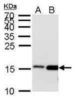 H3K27ac Antibody in Western Blot (WB)