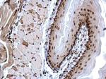 H3K4me3 Antibody in Immunohistochemistry (Paraffin) (IHC (P))