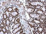 H3K4me3 Antibody in Immunohistochemistry (Paraffin) (IHC (P))