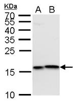 H3K4me3 Antibody in Western Blot (WB)