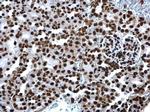 H4K8ac Antibody in Immunohistochemistry (Paraffin) (IHC (P))