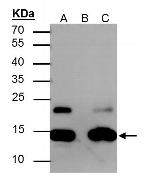 H2AK5ac Antibody in Immunoprecipitation (IP)