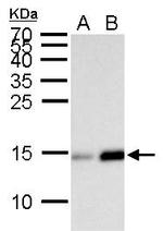 H2BK20ac Antibody in Western Blot (WB)