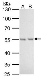 NAMPT Antibody in Western Blot (WB)