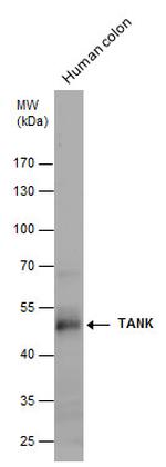 TANK Antibody in Western Blot (WB)