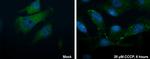 ATG16L1 Antibody in Immunocytochemistry (ICC/IF)