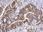 ATG16L1 Antibody in Immunohistochemistry (Paraffin) (IHC (P))