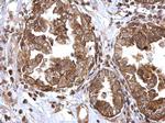 ATG16L1 Antibody in Immunohistochemistry (Paraffin) (IHC (P))