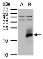 IGF2 Antibody in Western Blot (WB)