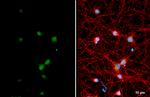 DLX2 Antibody in Immunocytochemistry (ICC/IF)