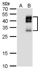 DLX2 Antibody in Western Blot (WB)