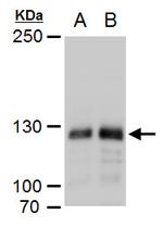 DNMT3A Antibody in Western Blot (WB)