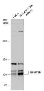 DNMT3B Antibody in Western Blot (WB)