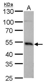 IRF4 Antibody in Western Blot (WB)