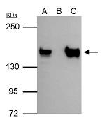 SIN3A Antibody in Immunoprecipitation (IP)