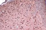 FOXP1 Antibody in Immunohistochemistry (Paraffin) (IHC (P))