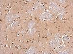 UBC9 Antibody in Immunohistochemistry (Paraffin) (IHC (P))