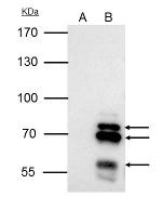 IKAROS Antibody in Immunoprecipitation (IP)