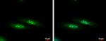 C1D Antibody in Immunocytochemistry (ICC/IF)