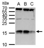 C1D Antibody in Western Blot (WB)