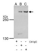 TRRAP Antibody in Immunoprecipitation (IP)