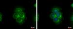 S100A9 Antibody in Immunocytochemistry (ICC/IF)