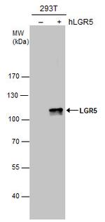 LGR5 Antibody in Western Blot (WB)