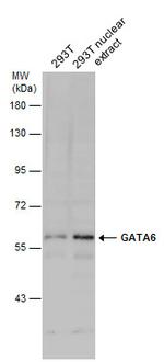 GATA6 Antibody in Western Blot (WB)