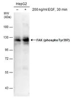 Phospho-FAK (Tyr397) Antibody in Western Blot (WB)