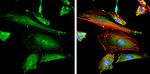 Phospho-FAK (Tyr397) Antibody in Immunocytochemistry (ICC/IF)