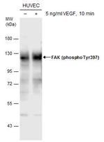 Phospho-FAK (Tyr397) Antibody in Western Blot (WB)