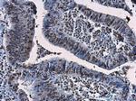 p14ARF Antibody in Immunohistochemistry (Paraffin) (IHC (P))