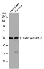 beta-3 Tubulin Antibody in Western Blot (WB)