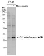 Phospho-EIF2S1 (Ser52) Antibody in Western Blot (WB)