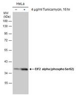 Phospho-EIF2S1 (Ser52) Antibody in Western Blot (WB)