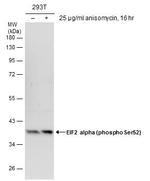 Phospho-EIF2S1 (Ser52) Antibody in Western Blot (WB)