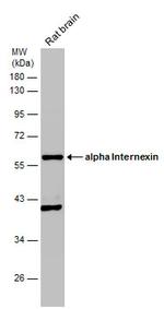 alpha Internexin Antibody in Western Blot (WB)