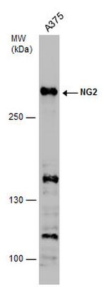 NG2 Antibody in Western Blot (WB)