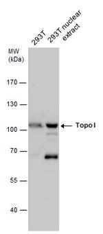 TOP1 Antibody in Western Blot (WB)