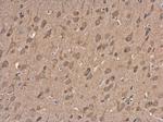 NMDAR2B Antibody in Immunohistochemistry (Paraffin) (IHC (P))