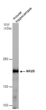 NMDAR2B Antibody in Western Blot (WB)