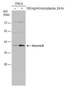 Aurora B Antibody in Western Blot (WB)