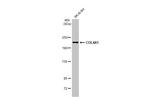 COL4A1 Antibody in Western Blot (WB)