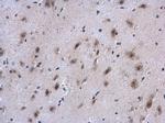 COL4A1 Antibody in Immunohistochemistry (Paraffin) (IHC (P))