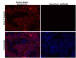 beta-3 Tubulin Antibody in Immunohistochemistry (Paraffin) (IHC (P))