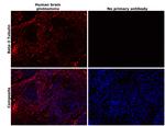 beta-3 Tubulin Antibody in Immunohistochemistry (Paraffin) (IHC (P))