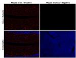 beta-3 Tubulin Antibody in Immunohistochemistry (Paraffin) (IHC (P))