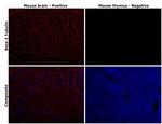 beta-3 Tubulin Antibody in Immunohistochemistry (Paraffin) (IHC (P))